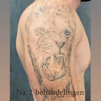 Een vervaagd leeuwentatoeage op een blote bovenarm.